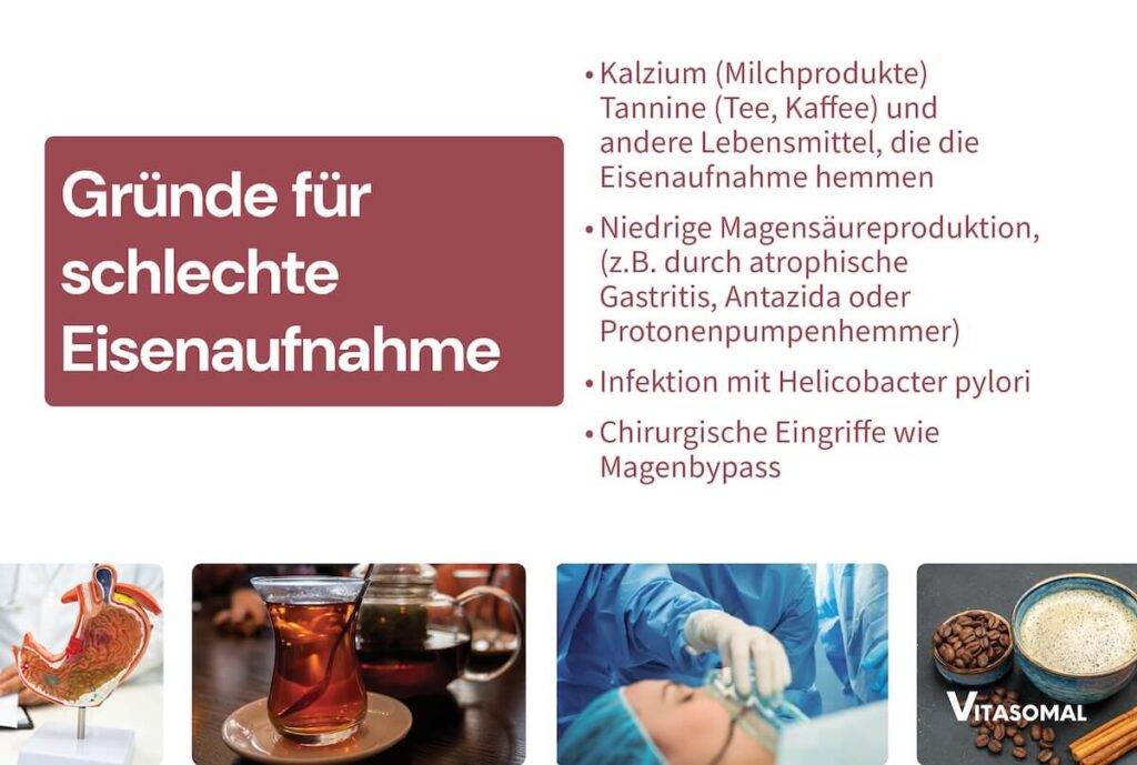 Augenringe durch Eisenmangel - Gründe für schlechte Eisenaufnahme