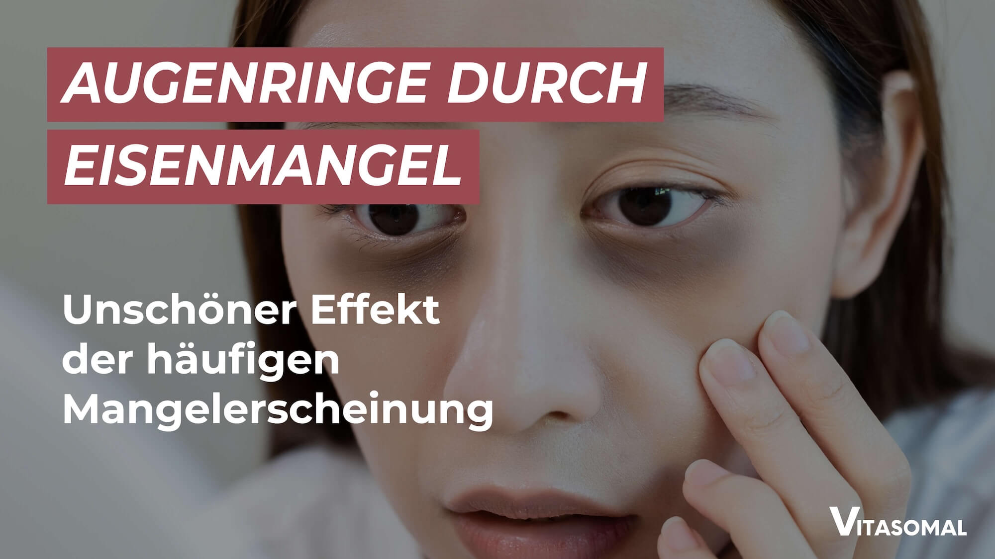 Eisenmangel Augenringe