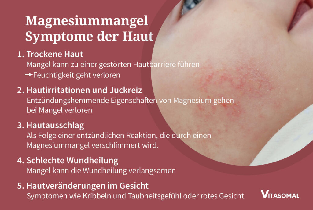 Magnesiummangel Symptome der Haut
