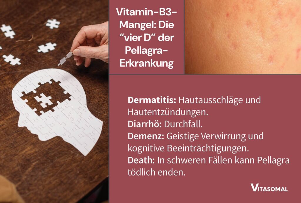 Vitamin B - Pellagra durch B3 Mangel