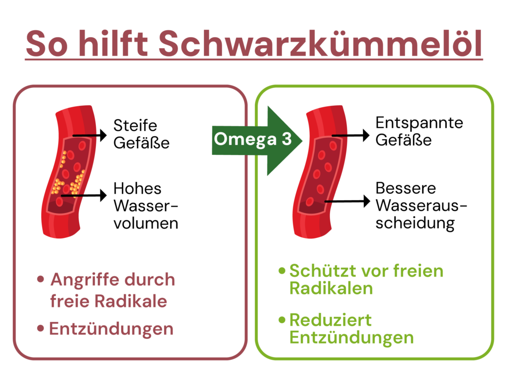 So hilft Schwarzkümmelöl