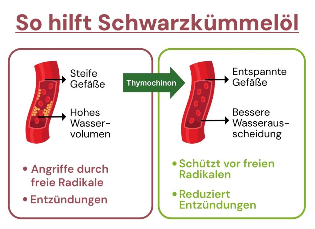 so-hilft-schwarzkümmelöl